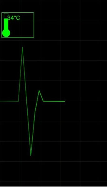 ECG LWP v1.2