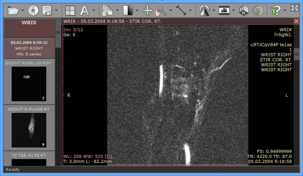 RadiAntDICOM Viewer PC-v2025.1