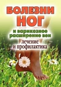 Болезни ног и варикозное расширение вен