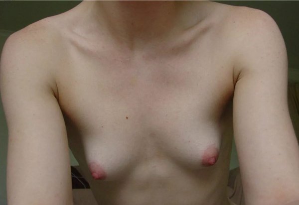 i (78)