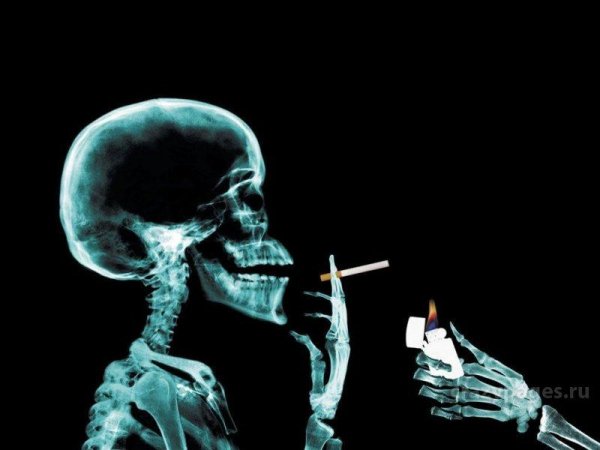 Crazy X-Ray 128x160