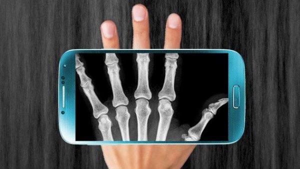 X-Ray Scanner Prank v1.1.2