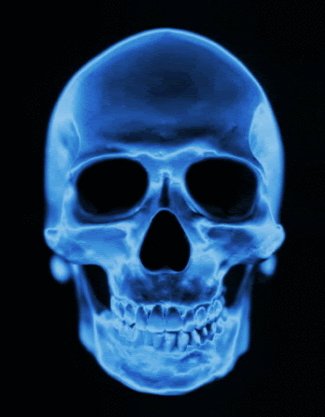 skull