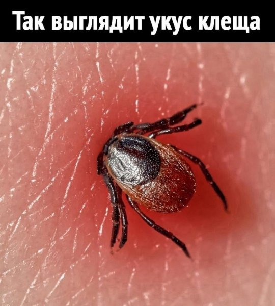 g7dCIFv3b8M