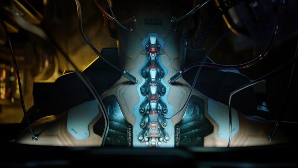 Cyberpunk-2077-spine-exoskeleton