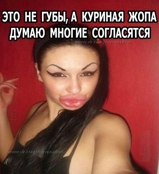 Жопа